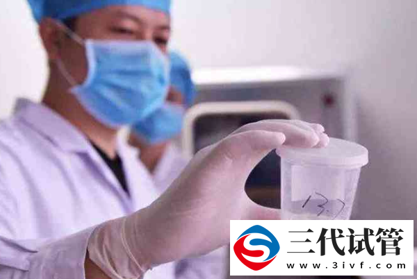 性激素六项怎么检查,性激素六项检查需要空腹吗(图1)
