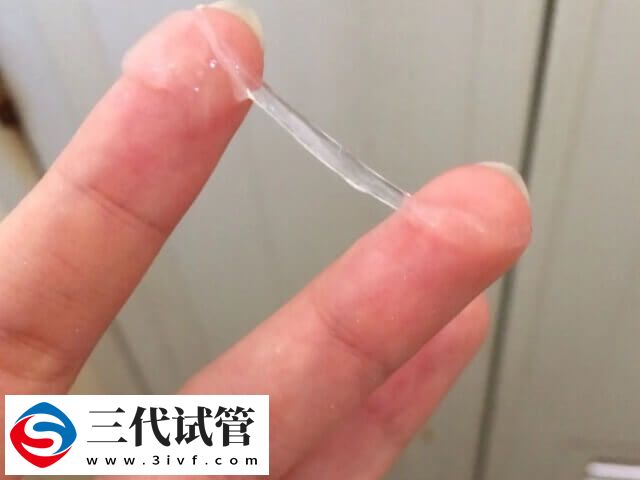 白带常规有哪些检查项目(图2)