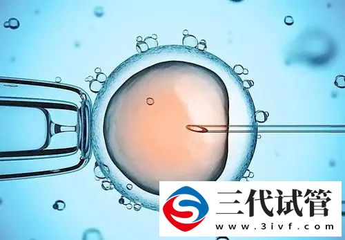 试管一、二、三代有何区别？(图2)