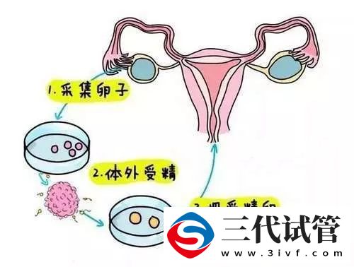 1代、2代、3代试管，有什么区别？哪个适合你？(图1)