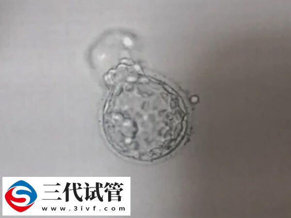 鲜胚移植成功率90%是不是真的(图1)