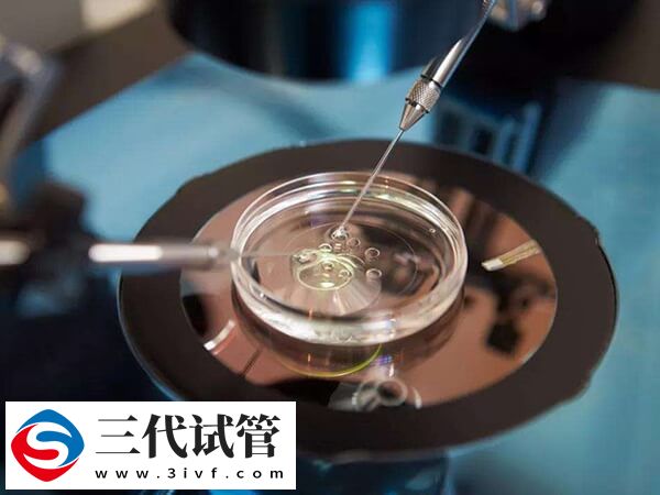 第三代试管pgt筛查后会有唐氏宝宝吗？(图1)