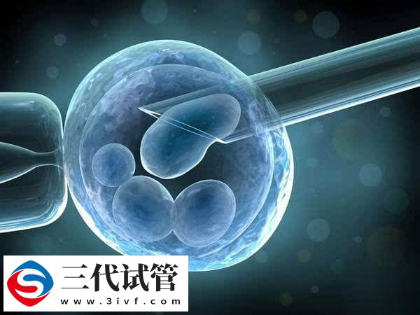 三代试管促排和手术要花多少钱(图2) 三代试管促排和手术要花多少钱(图2)