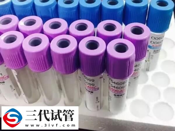 试管婴儿前期男女又方全套体检多少钱？(图1)