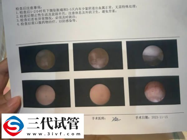 降调卵泡不均匀是怎么回事(图2)