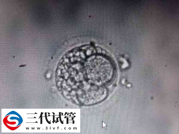 13细胞胚胎怎么样(图1) 13细胞胚胎怎么样(图1)