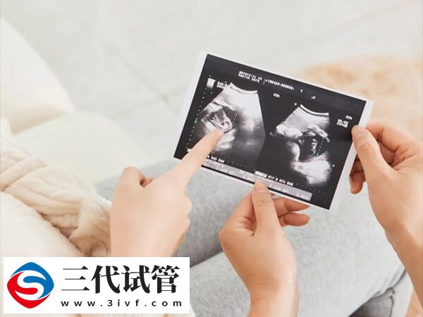 三代试管婴儿囊胚移植宫外孕多久能确诊查出来？(图1)