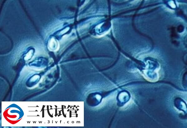 导致男性不孕不育症的原因有哪些(图2) 导致男性不孕不育症的原因有哪些(图2)