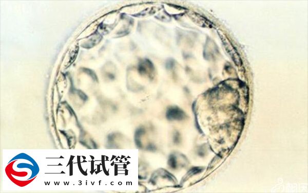 4cb囊胚是不是质量最差的(图2)