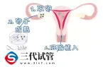试管婴儿失败后最多能做几次，影响健康吗？