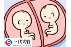 试管移植双胞胎有什么风险