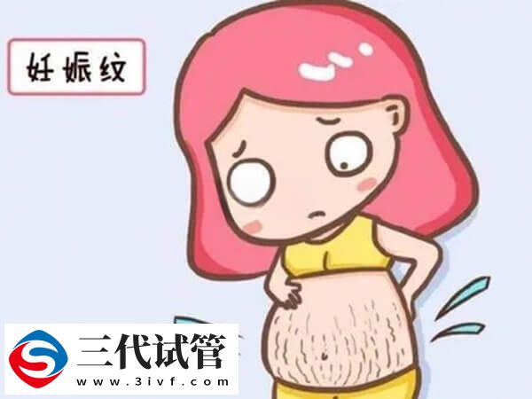 白色妊娠纹和红色妊娠纹有什么不同(图1)